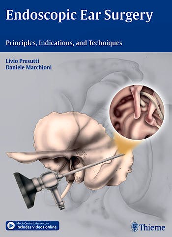 Portada del libro 9783131630414 Endoscopic Ear Surgery. Principles, Indications and Techniques + Content Online