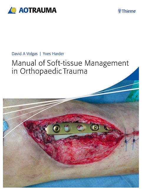 Portada del libro 9783131663719 Manual of Soft-Tissue Management in Orthopaedic Trauma