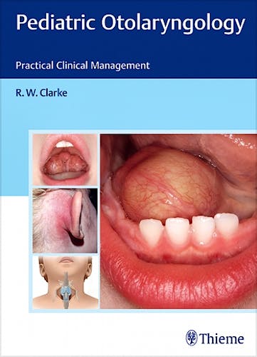 Portada del libro 9783131699015 Pediatric Otolaryngology. Practical Clinical Management