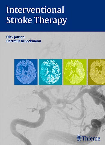 Portada del libro 9783131699213 Interventional Stroke Therapy