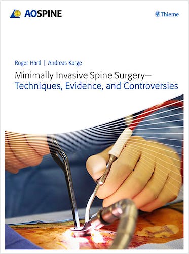 Portada del libro 9783131723819 Minimally Invasive Spine Surgery. Techniques, Evidence, and Controversies