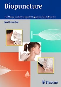 Portada del libro 9783131752215 Biopuncture. The Management of Common Orthopedic and Sports Disorders