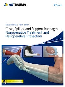 Portada del libro 9783131753410 Casts, Splints, and Support Bandages. Nonoperative Treatment and Perioperative Protection
