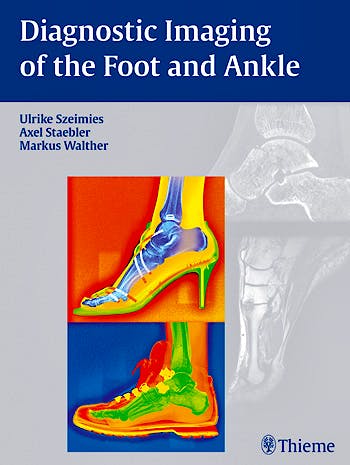 Portada del libro 9783131764614 Diagnostic Imaging of the Foot and Ankle