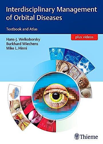 Portada del libro 9783131994219 Interdisciplinary Management of Orbital Diseases. Textbook and Atlas + Videos Online