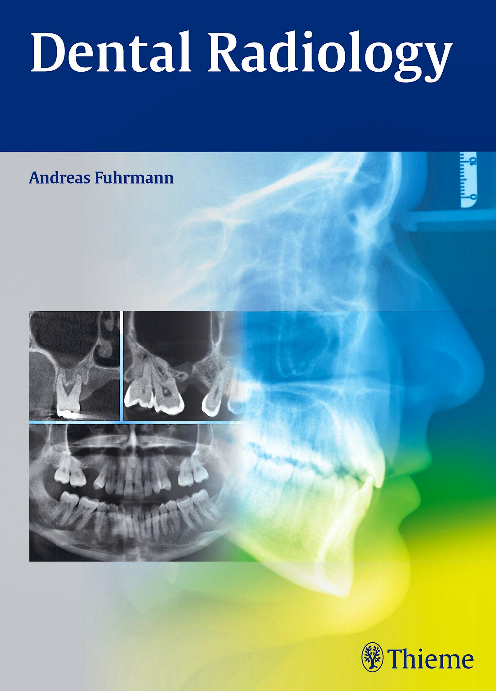 Portada del libro 9783132004214 Dental Radiology