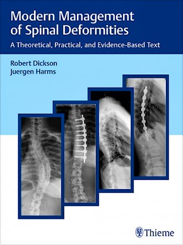 Portada del libro 9783132016316 Modern Management of Spinal Deformities. A Theoretical, Practical and Evidence-Based Text