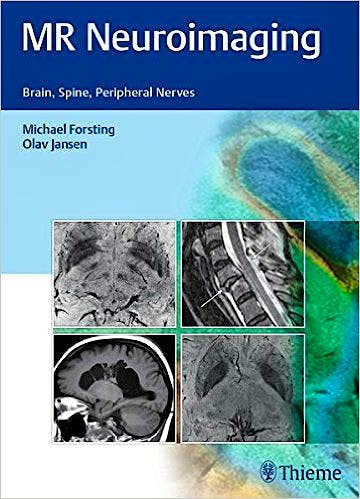 Portada del libro 9783132026810 Mr Neuroimaging: Brain, Spine, and Peripheral Nerves