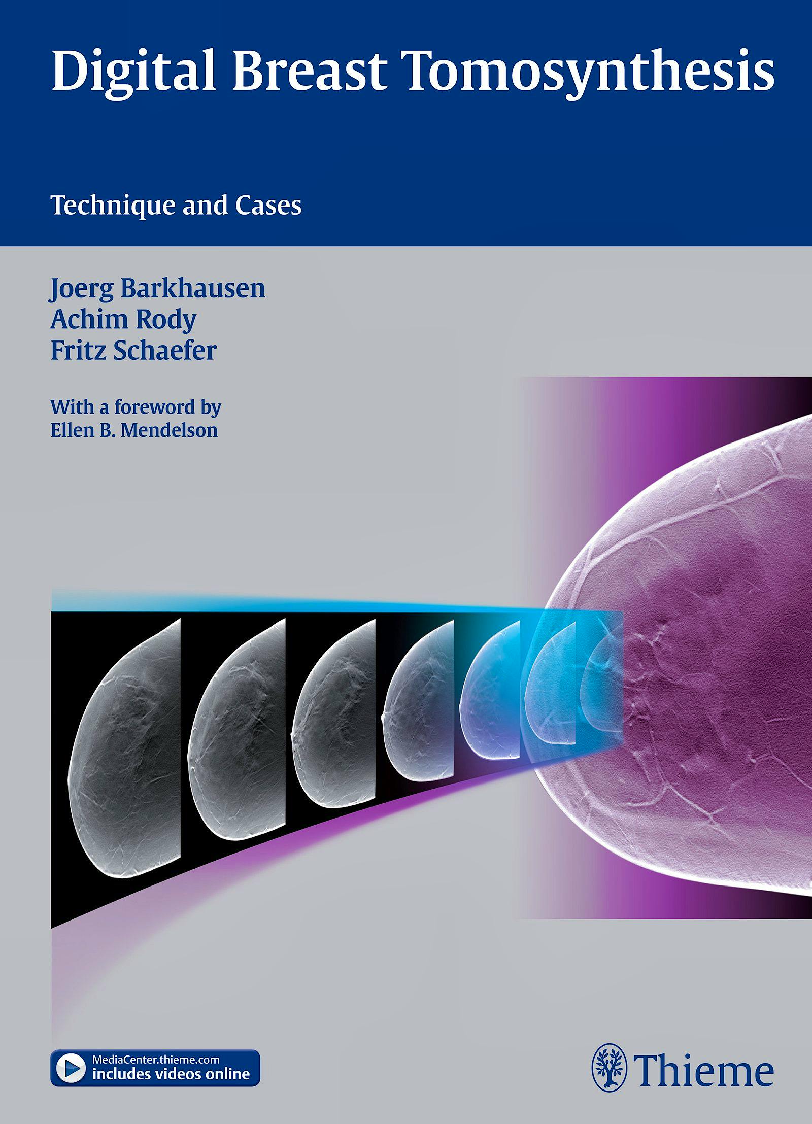 Portada del libro 9783132031616 Digital Breast Tomosynthesis. Technique and Cases