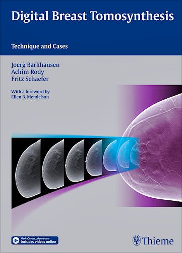 Portada del libro 9783132031616 Digital Breast Tomosynthesis. Technique and Cases