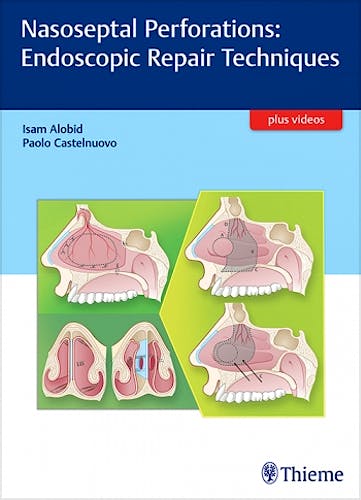 Portada del libro 9783132053915 Nasoseptal Perforations: Endoscopic Repair Techniques + Videos
