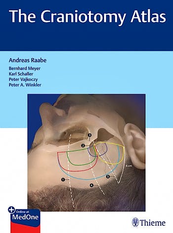 Portada del libro 9783132057913 The Craniotomy Atlas