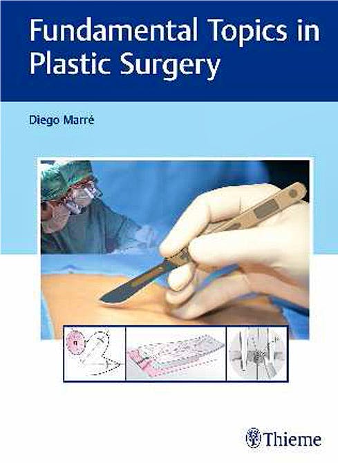 Portada del libro 9783132059115 Fundamental Topics in Plastic Surgery