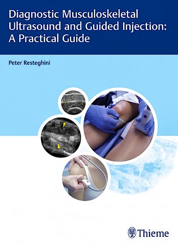 Portada del libro 9783132203815 Diagnostic Musculoskeletal Ultrasound and Guided Injection. A Practical Guide