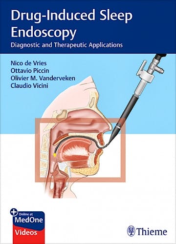 Portada del libro 9783132403468 Drug-Induced Sleep Endoscopy. Diagnostic and Therapeutic Applications