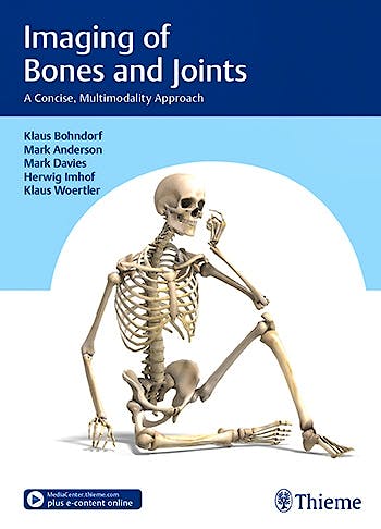 Portada del libro 9783132406476 Imaging of Bones and Joints. A Concise, Multimodality Approach