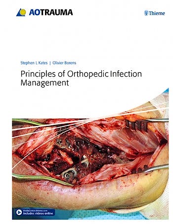 Portada del libro 9783132410756 Principles of Orthopedic Infection Management + Online Videos