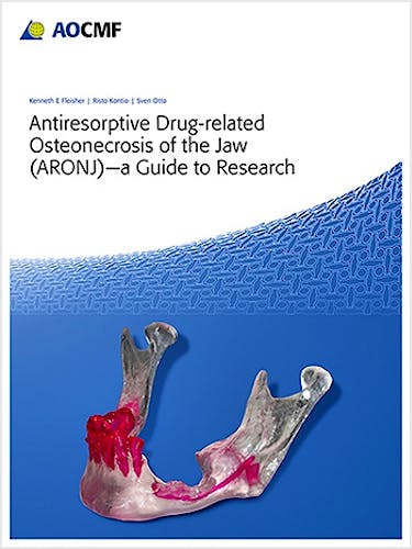 Portada del libro 9783132412705 Antiresorptive Drug-Related Osteonecrosis of the Jaw (ARONJ). A Guide to Research