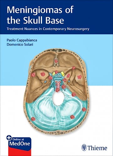 Portada del libro 9783132412866 Meningiomas of the Skull Base. Treatment Nuances in Contemporary Neurosurgery