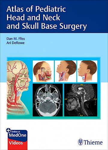 Portada del libro 9783132414273 Atlas of Pediatric Head and Neck and Skull Base Surgery