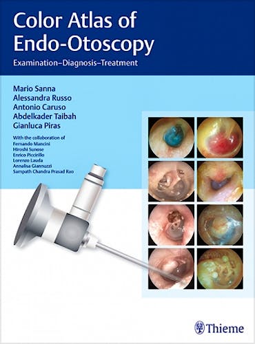 Portada del libro 9783132415232 Color Atlas of Endo-Otoscopy. Examination-Diagnosis-Treatment