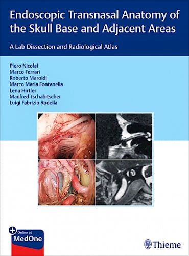 Portada del libro 9783132415621 Endoscopic Transnasal Anatomy of the Skull Base and Adjacent Areas. A Lab Dissection and Radiological Atlas