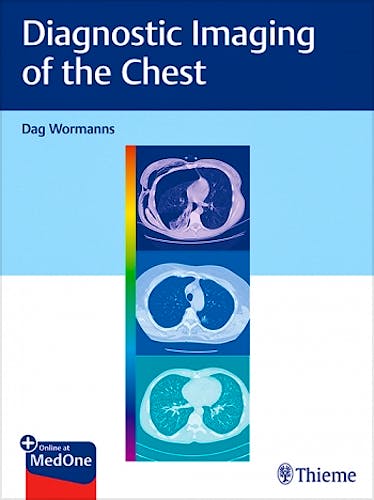 Portada del libro 9783132415652 Diagnostic Imaging of the Chest