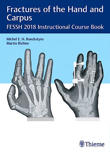 Portada del libro 9783132417205 Fractures of the Hand and Carpus. FESSH 2018 Instructional Course Book