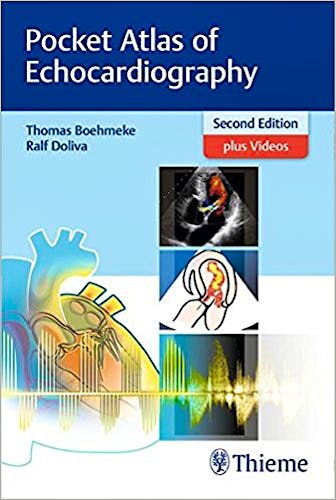 Portada del libro 9783132417229 Pocket Atlas of Echocardiography