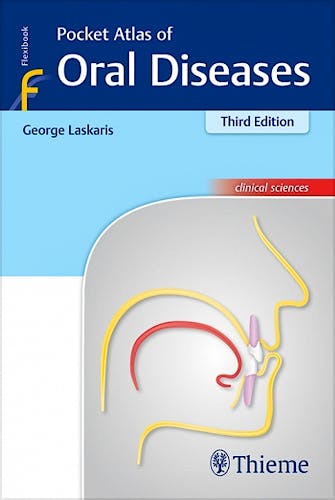 Portada del libro 9783132417878 Pocket Atlas of Oral Diseases