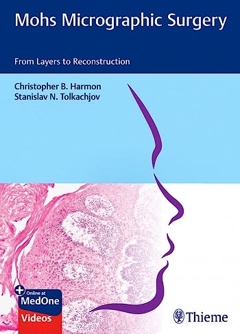 Portada del libro 9783132420175 Mohs Micrographic Surgery. From Layers to Reconstruction