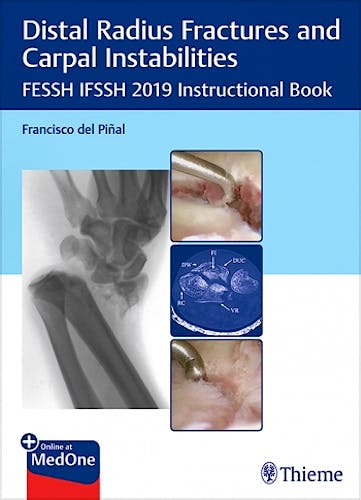 Portada del libro 9783132423794 Distal Radius Fractures and Carpal Instabilities. FESSH IFSSH 2019 Instructional Book
