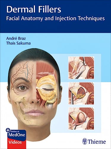 Portada del libro 9783132427723 Dermal Fillers. Facial Anatomy and Injection Techniques