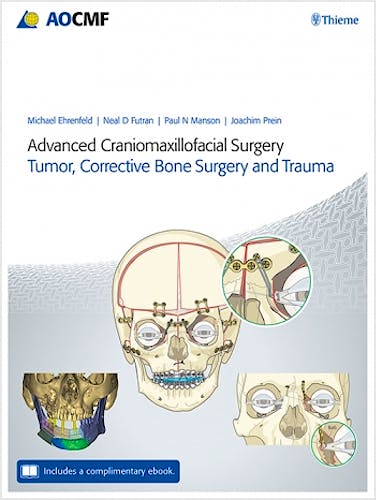 Portada del libro 9783132428393 Advanced Craniomaxillofacial Surgery. Tumor, Corrective Bone Surgery, and Trauma