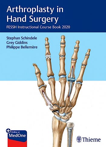 Portada del libro 9783132431744 Arthroplasty in Hand Surgery. FESSH Instructional Course Book 2020
