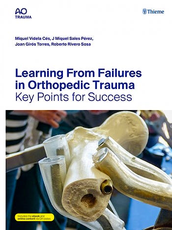 Portada del libro 9783132434561 Learning From Failures in Orthopedic Trauma. Key Points for Success