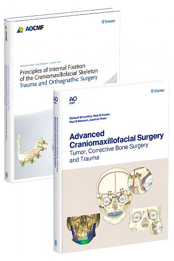 Portada del libro 9783132442566 Complete Craniomaxillofacial Surgery (2 Volume Set)