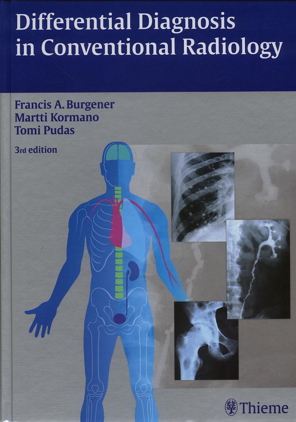 Portada del libro 9783136561034 Differential Diagnosis in Conventional Radiology