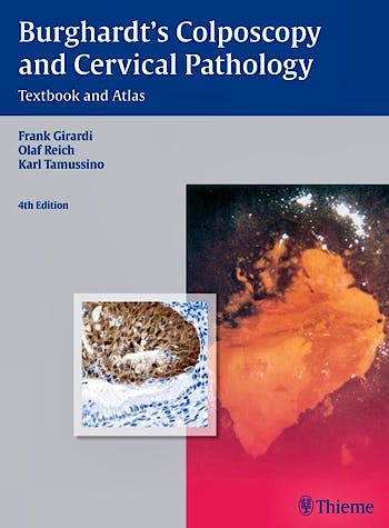 Portada del libro 9783136599044 Burghardt's Colposcopy and Cervical Pathology. Textbook and Atlas