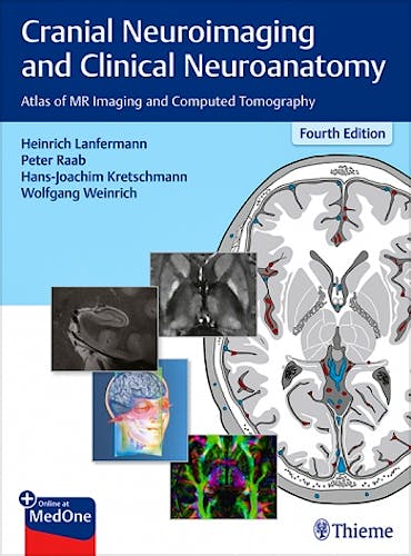 Portada del libro 9783136726044 Cranial Neuroimaging and Clinical Neuroanatomy. Atlas of MR Imaging and Computed Tomography