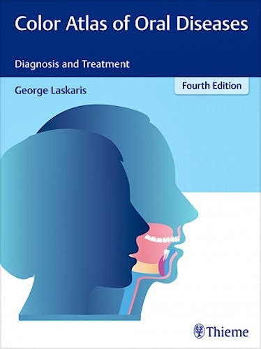 Portada del libro 9783137170044 Color Atlas of Oral Diseases. Diagnosis and Treatment
