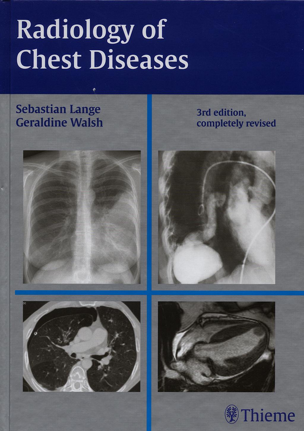 Portada del libro 9783137407034 Radiology of Chest Diseases