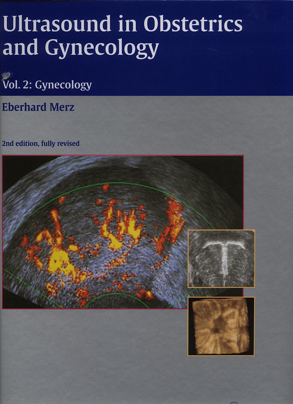 Portada del libro 9783137544029 Ultrasound in Obstetrics and Gynecology, Vol 2: Gynecology