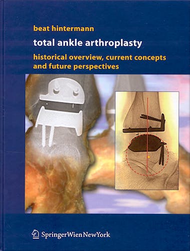 Portada del libro 9783211212523 Total Ankle Arthroplasty. Historical Overview, Current Concepts and Future Perspectives