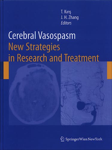 Portada del libro 9783211757178 Cerebral Vasospasm New Strategies in Research and Treatment