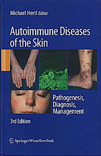 Portada del libro 9783211992241 Autoimmune Diseases of the Skin. Pathogenesis, Diagnosis, Management