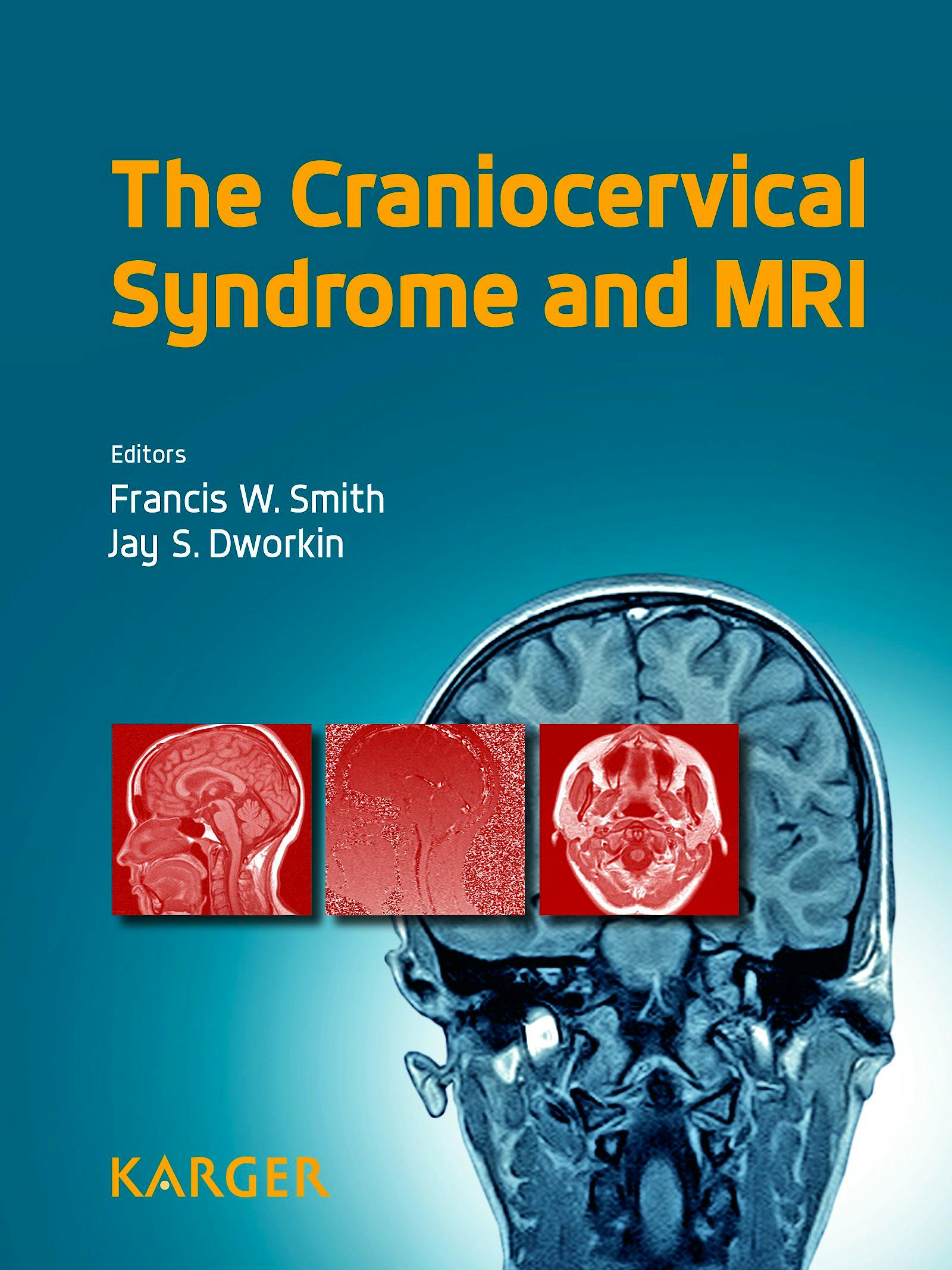 Portada del libro 9783318026962 The Craniocervical Syndrome and Mri