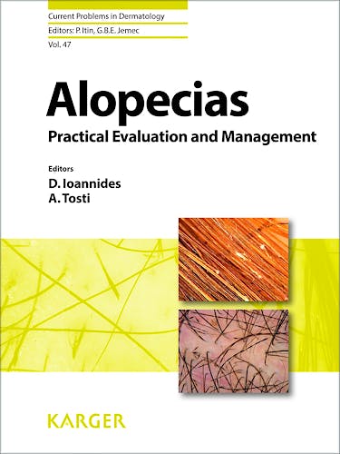 Portada del libro 9783318027747 Alopecias - Practical Evaluation and Management (Current Problems in Dermatology, Vol. 47)