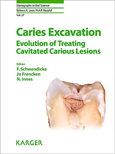 Portada del libro 9783318063684 Caries Excavation. Evolution of Treating Cavitated Carious Lesions (Monographs in Oral Science, Vol. 27)