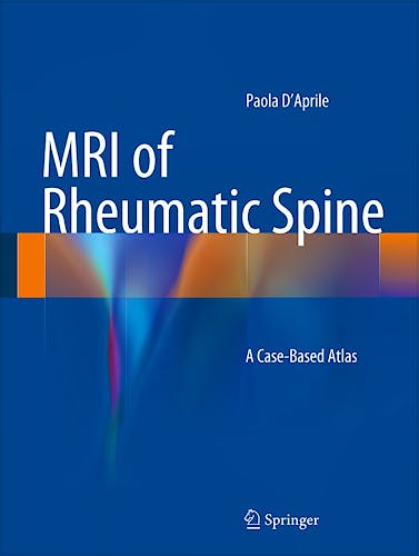 Portada del libro 9783319056265 Mri of Rheumatic Spine. a Case-Based Atlas